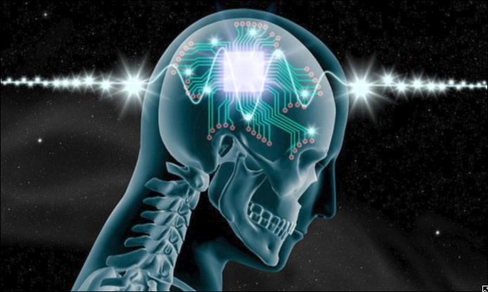 Neuronal Device